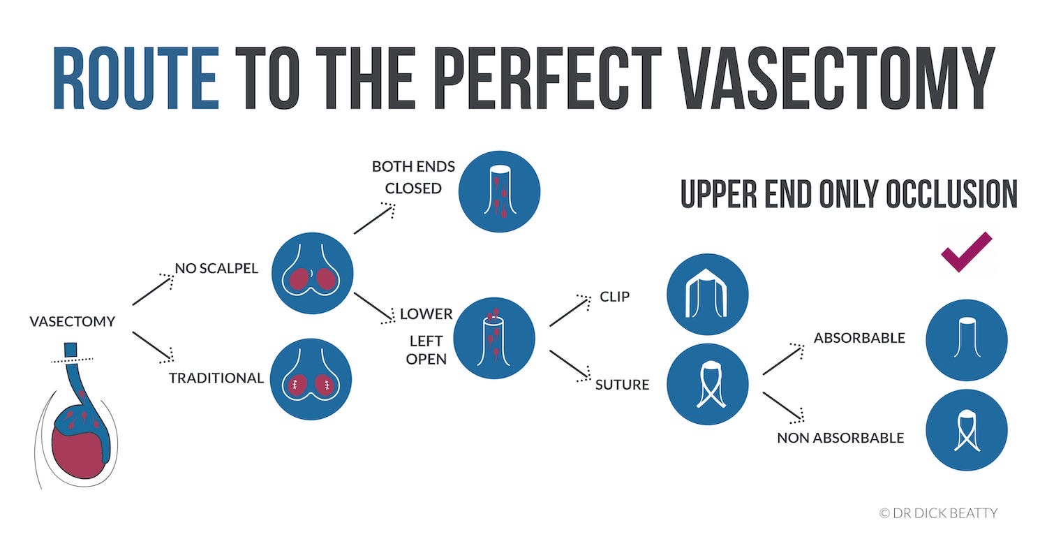 Route to the perfect vasectomy: Illustration of technique from left to right (pre-vasectomy, no-scalpel.v.traditional, open .v. closed, clip .v. suture, absorbable suture .v. non-absorbable suture)
