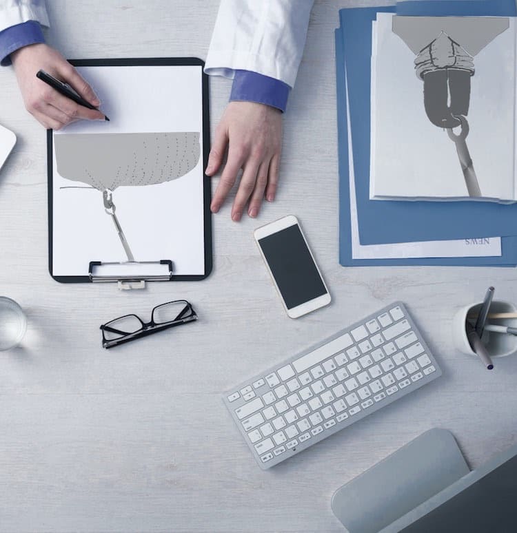 Doctor drawing vasectomy technique, with glasses, pens, computer - suggesting professionalism.